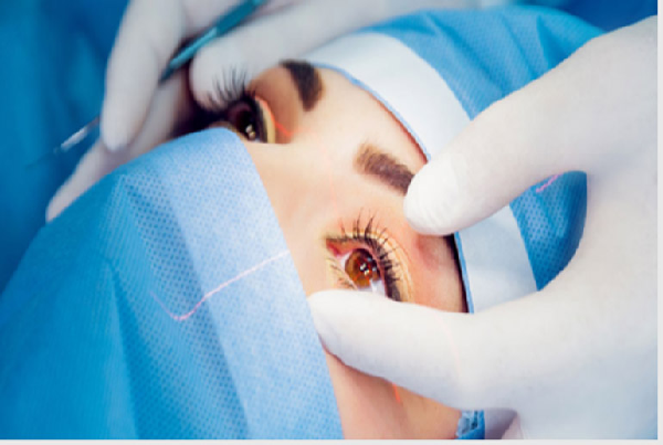 Glaucoma Services